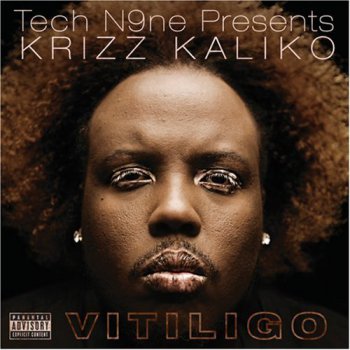 Krizz Kaliko-Vitiligo 2008