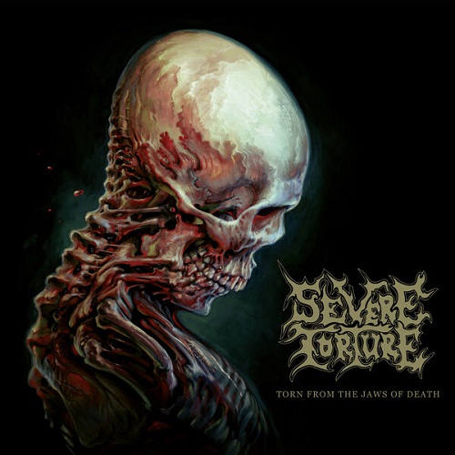 Severe Torture - Torn from the Jaws of Death 2024