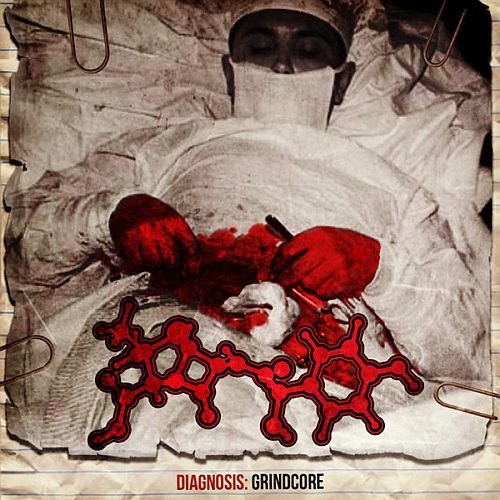 Amoclen - Diagnosis: Grindcore (2018)